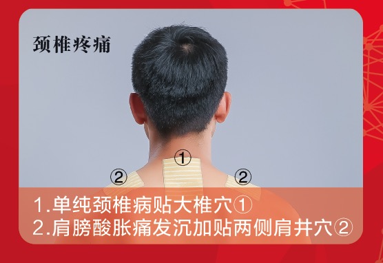 老倪祖三贴膏药之颈椎穴位贴法