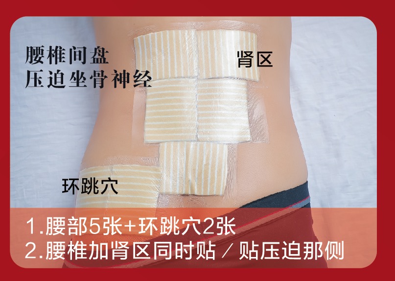 老倪祖三贴膏药之腰部穴位贴法