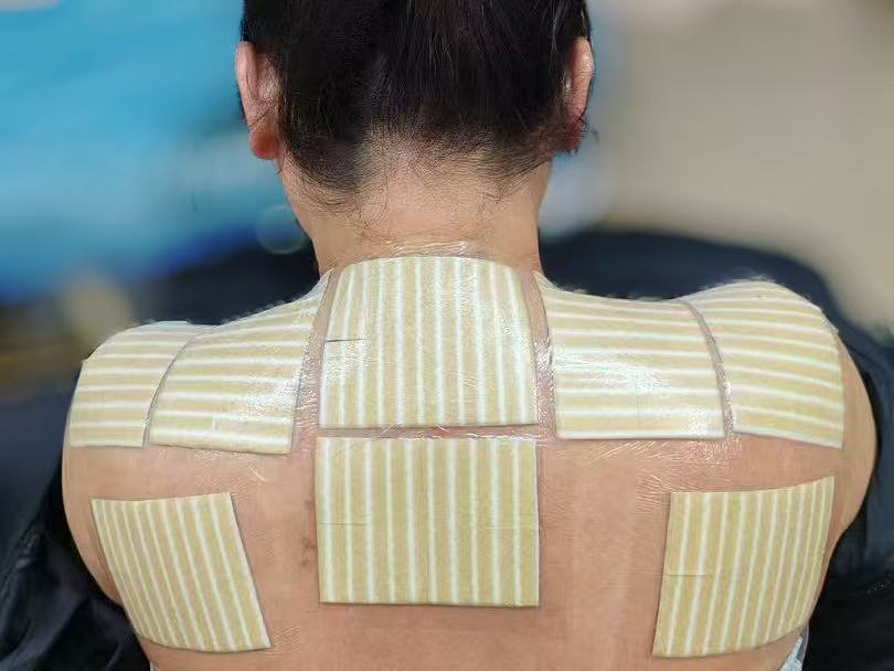 老倪祖三贴怎么贴颈椎和肩膀？有没有参考图？