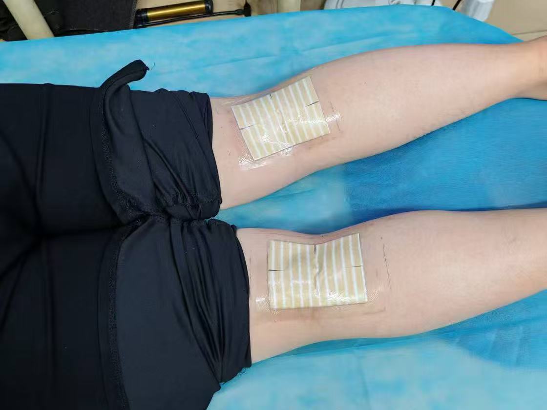 老倪祖三贴在腰和背上怎么贴？委中求是什么意思？