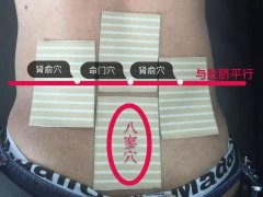 老倪祖三贴腰部怎么贴