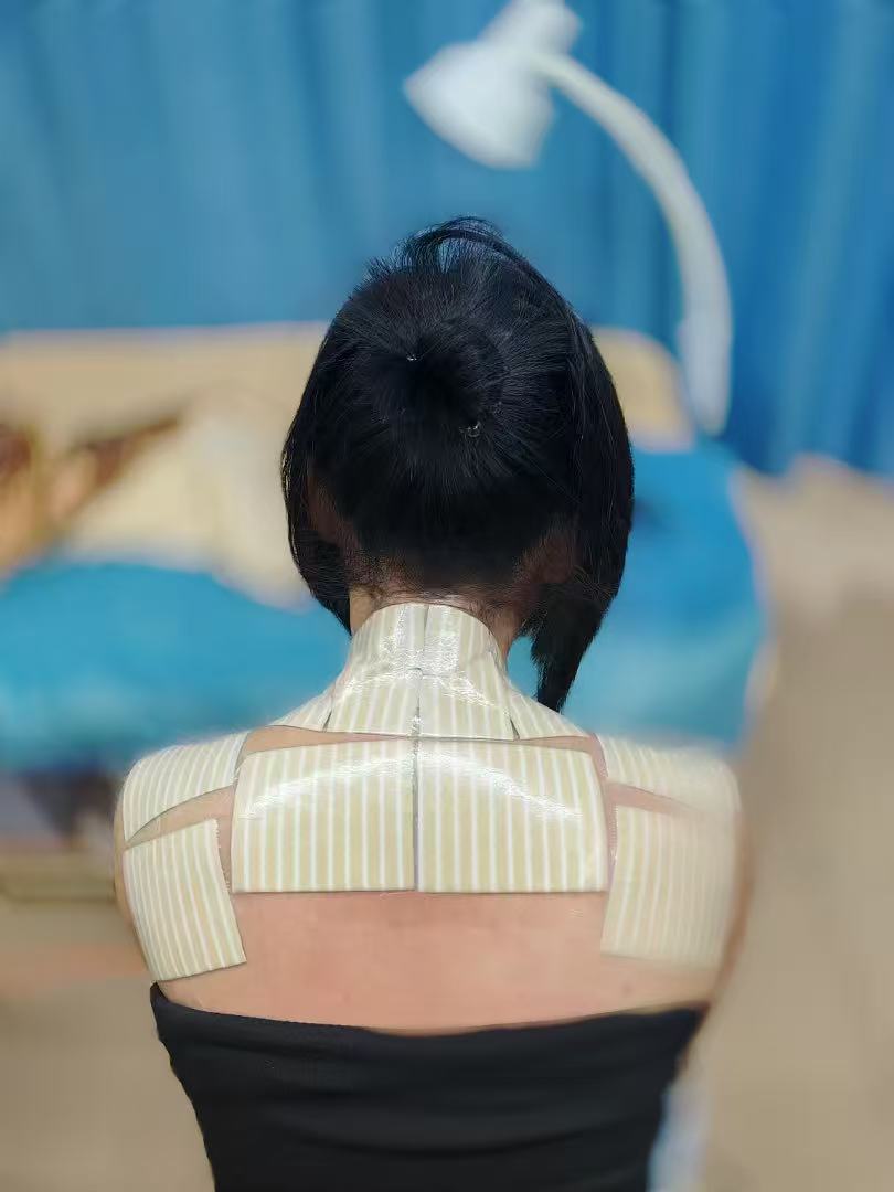 老倪祖三贴脖子部位贴敷示意图