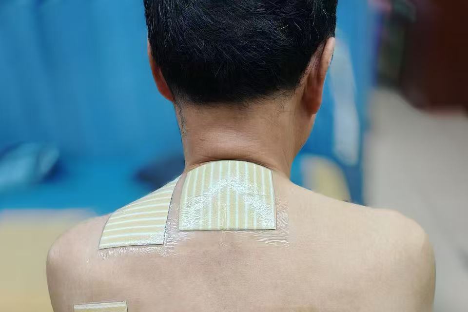 老倪祖三贴正确规范贴敷方法图解