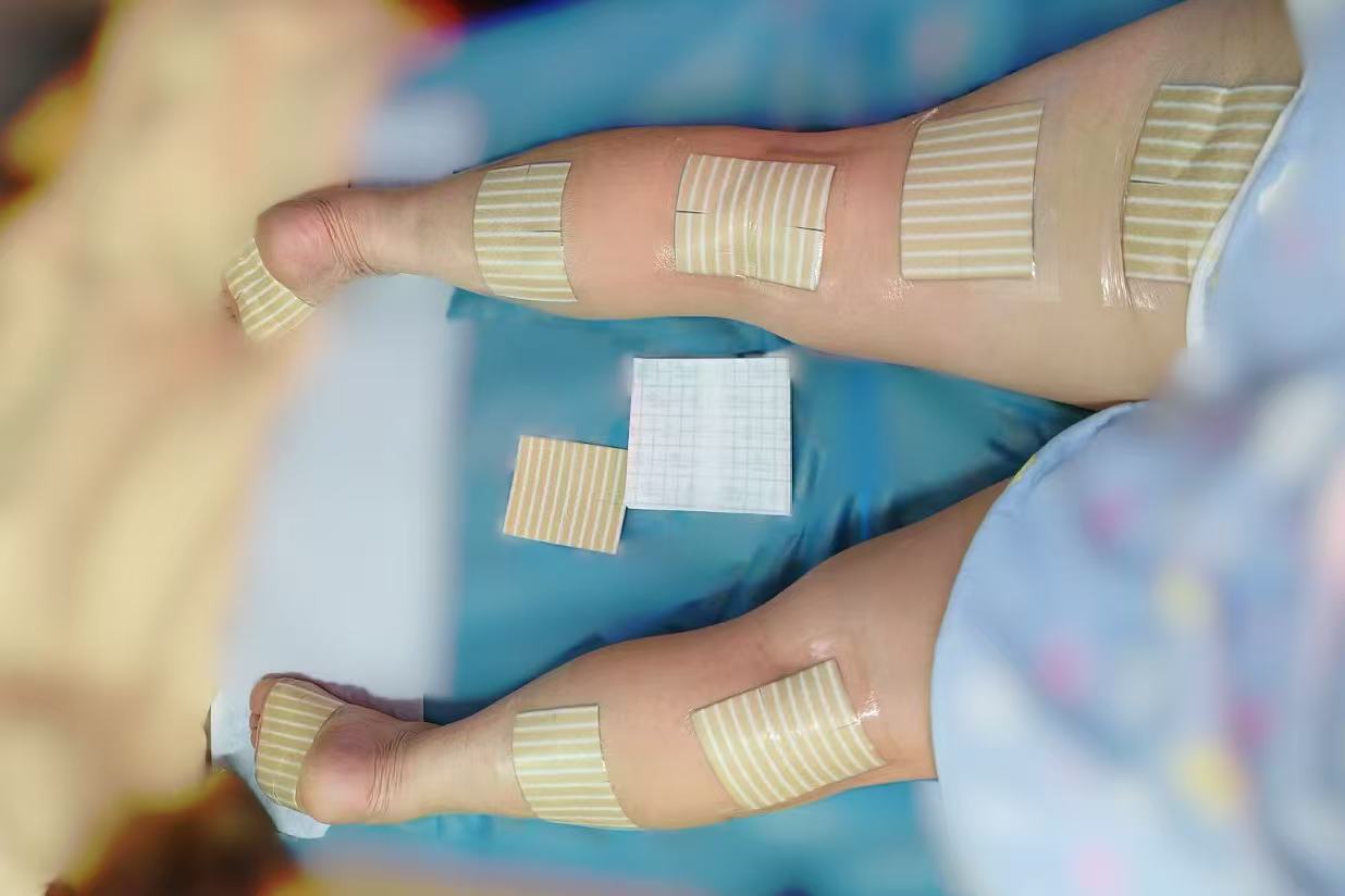 老倪祖三贴贴后发痒是怎么回事