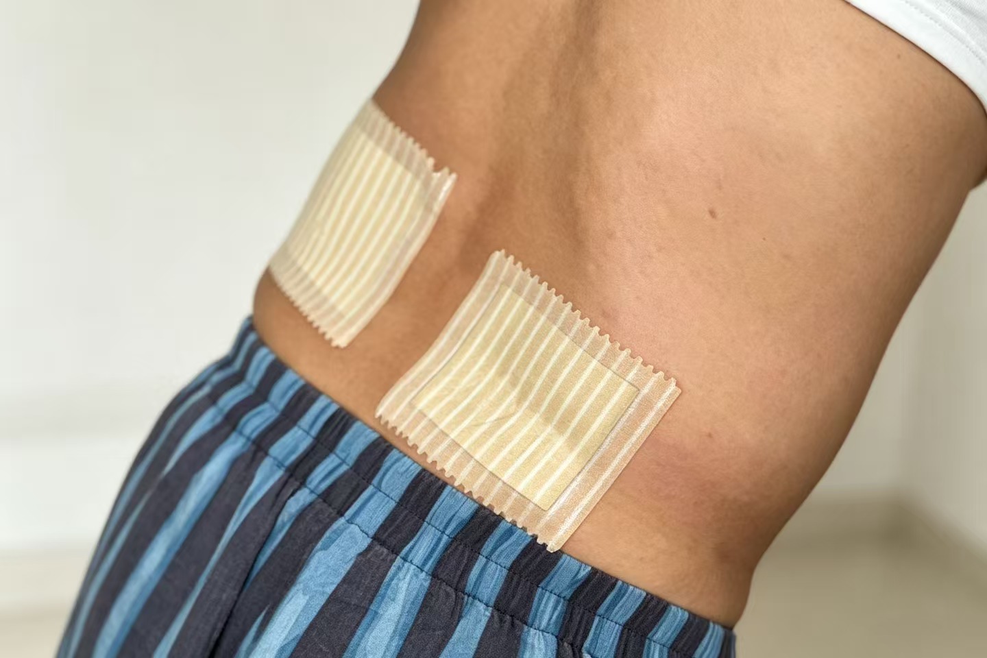老倪祖三贴双侧腰肌贴法